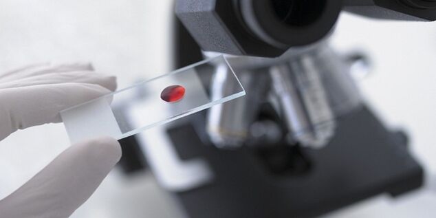 Bluttest zur Diagnose von Parasiten im Körper