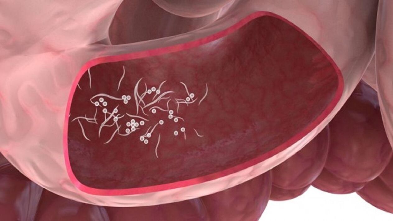 Giardia-Parasiten in der Leber