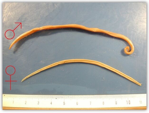 Wie sehen Nematoden aus